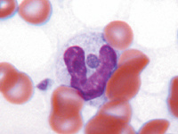 White blood cell containing an Ehrlichia organism